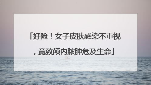 好险！女子皮肤感染不重视，竟致颅内脓肿危及生命